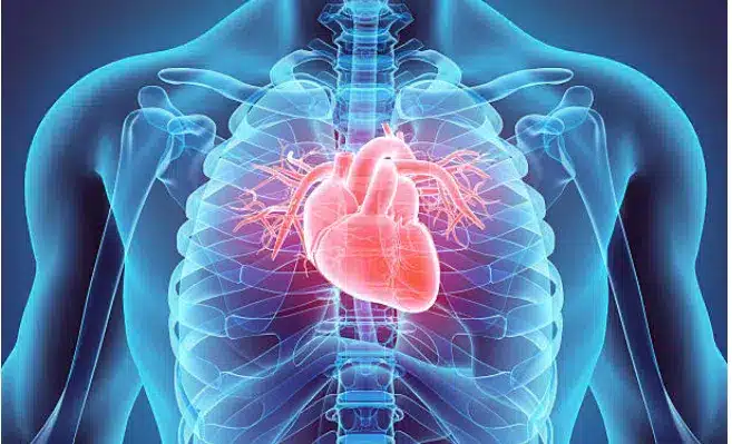 Crise cardiaque